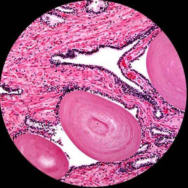 1000X Trinocular Biological Compound Microscope with 14MP USB Digital Camera K9509